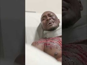 Steroids, Surgery, and a Plea: Will He Walk Again? | Friends Like Sisters #stashblackstories